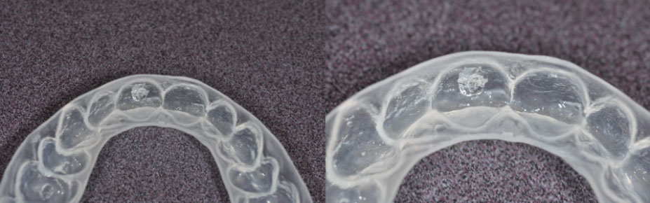 x ray scan for teeth